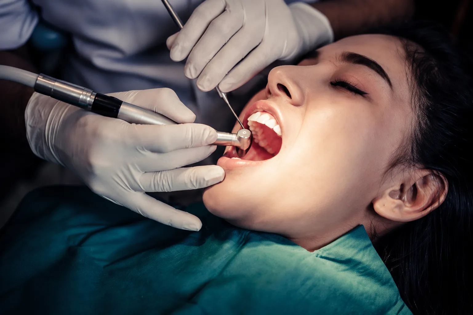dental cleaning