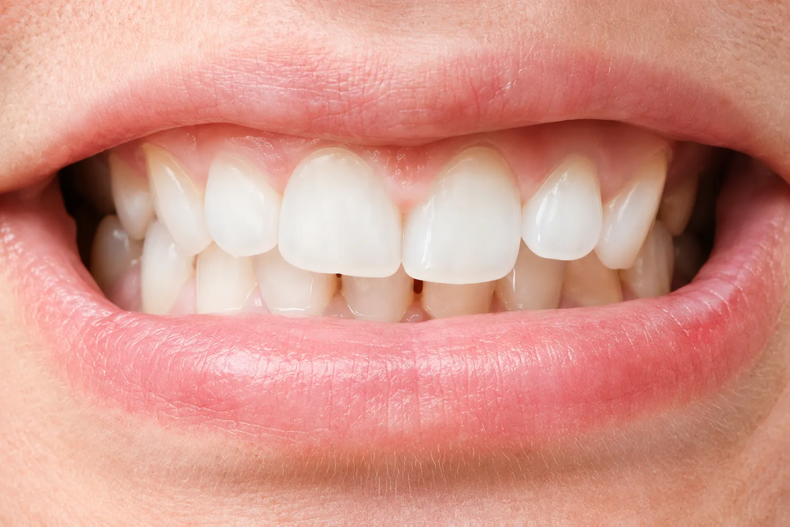 smile