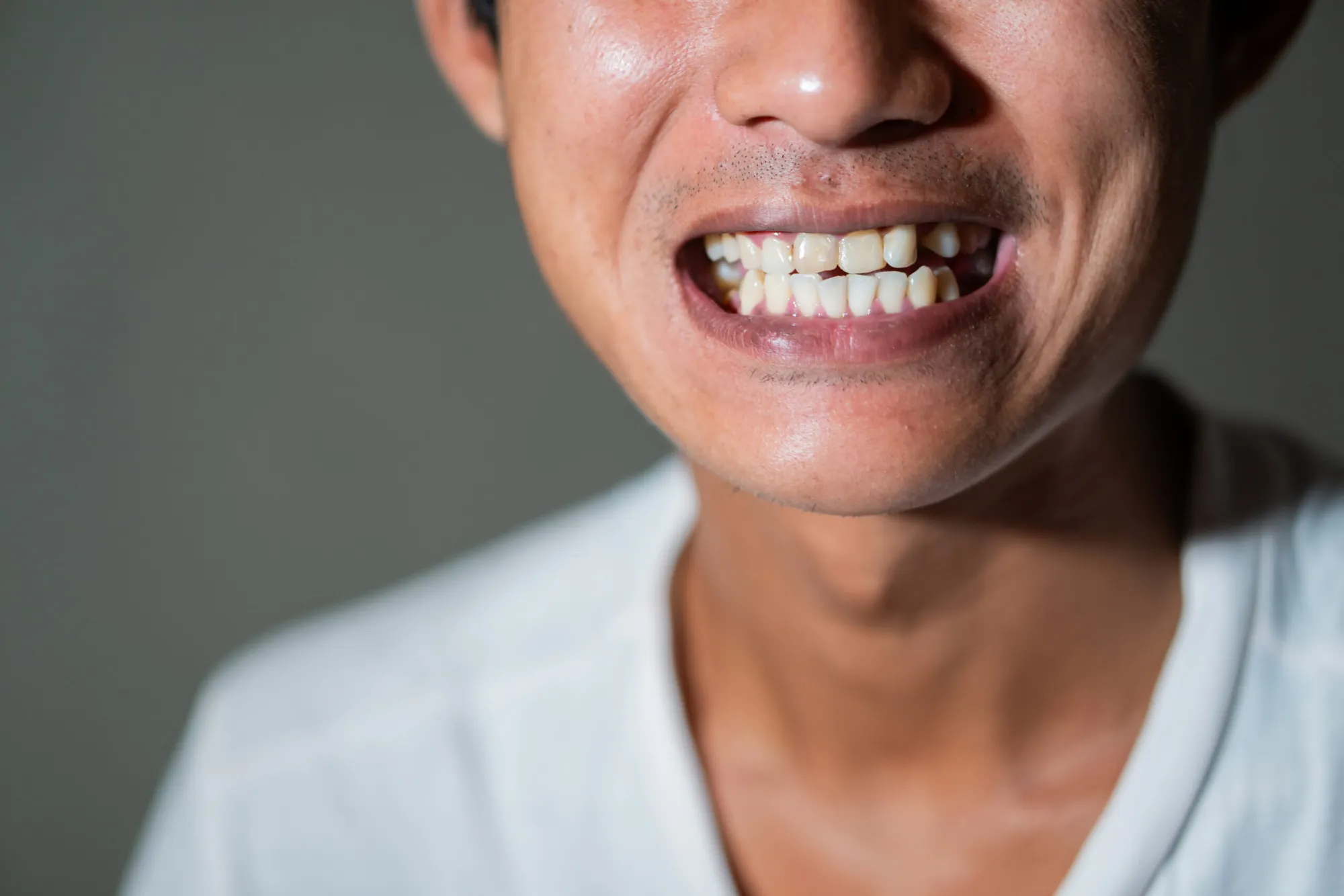 Teeth
