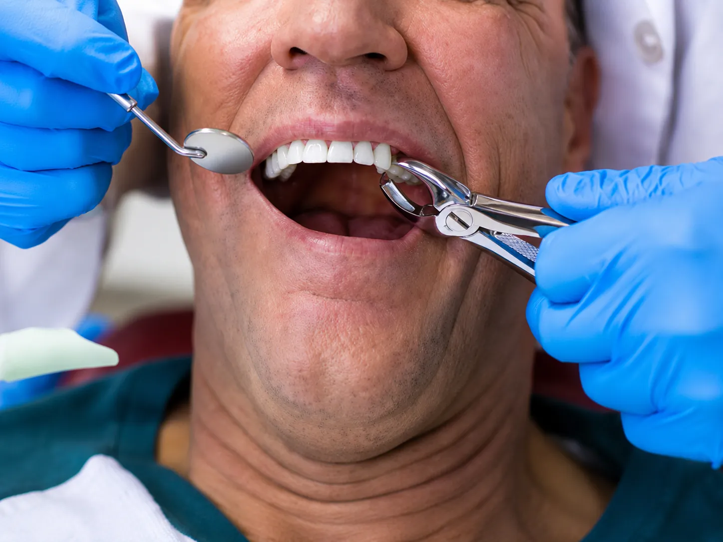 tooth check