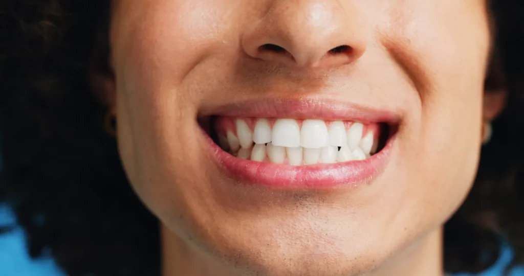 teeth grind
